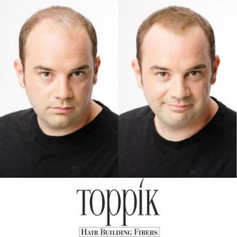 toppik vorher nachher